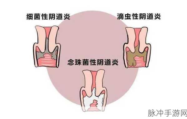 胡桃阴道违反白色液体：胡桃阴道的神秘液体：探索白色分泌物的奥秘与健康影响