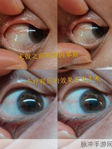 穿越到胬肉系统的小说：穿越胬肉系统：重塑人生的奇幻旅程