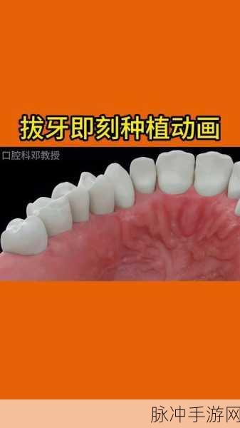 拔牙大师，挑战你的模拟拔牙技艺，即刻下载体验！